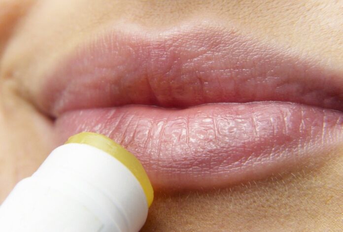 Como controlar o Herpes labial ou genital com suplemento de Lisina
