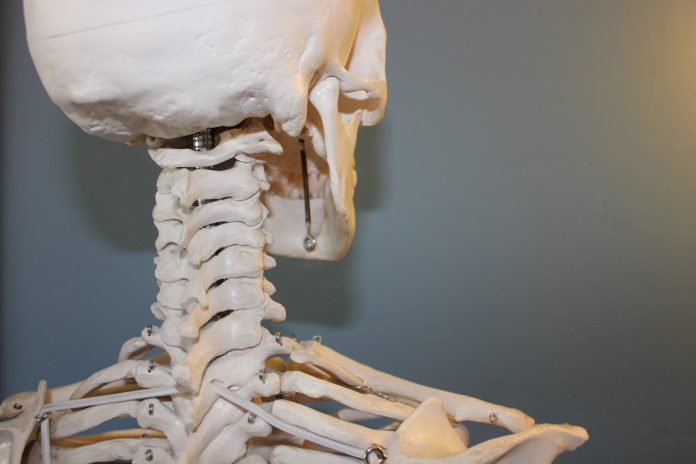 Principais sintomas da Osteoporose e como prevenir a doença